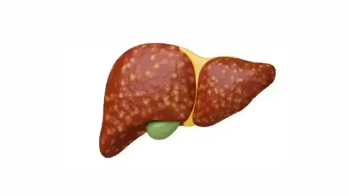 What is the Coverage for Cirrhosis Treatment in Health Insurance?